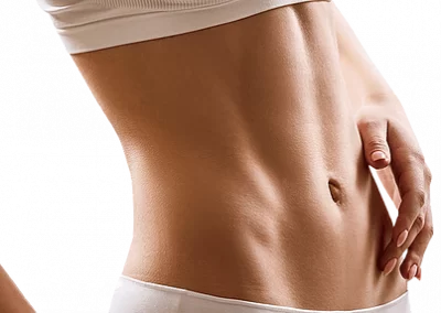 ABDOMINOPLASTIA