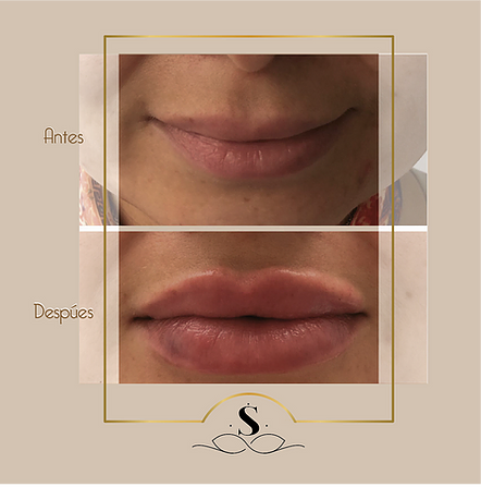 LABIOS