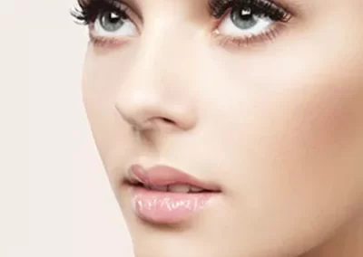 Radiesse®