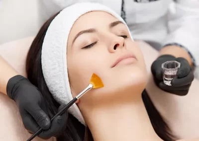 Ácido Hialurónico para contorno mandibular